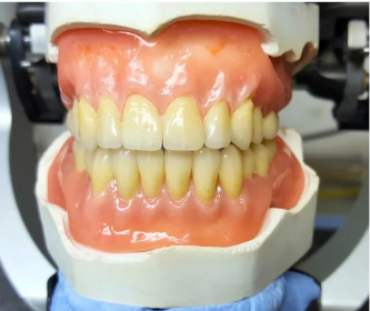 Dentures